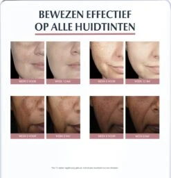 Eucerin Anti-Pigment Spotcorrector - Concealer - 5 Ml -Maquillage Cosmetics 1157x1200