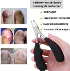 Merkloos Nageltang Voor Harde Teennagels - Manicureset Teennagelknipper - Teennagelschaar - Pedicure Set 11 Merkloos Nageltang Voor Harde Teennagels - Manicureset Teennagelknipper - Teennagelschaar - Pedicure Set -Maquillage Cosmetics 1196x1200 38