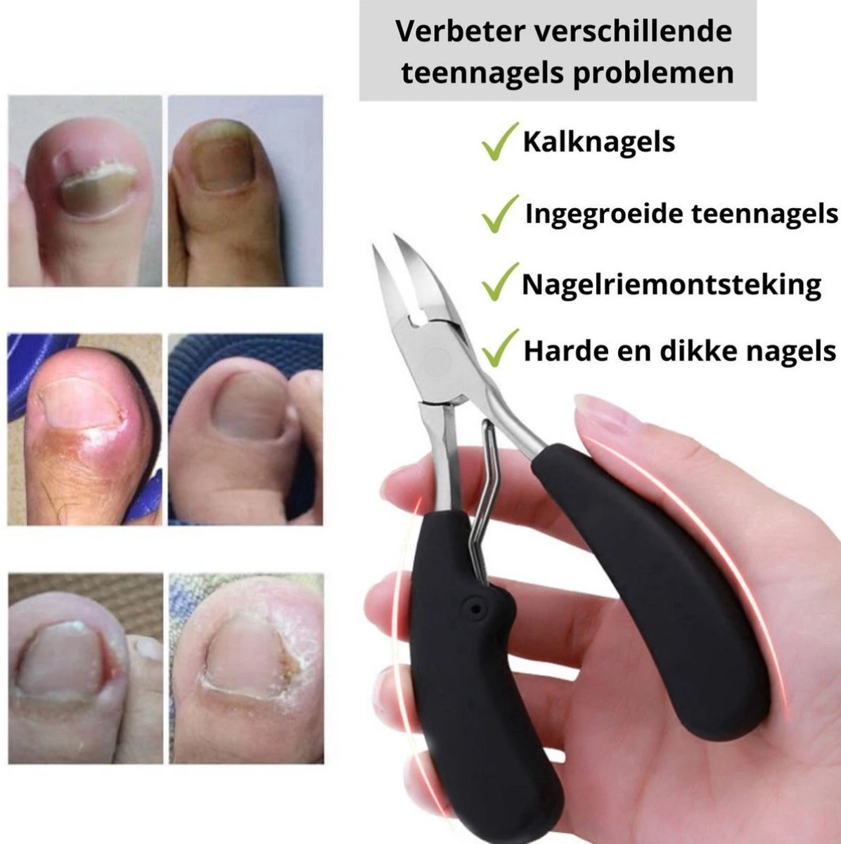 Merkloos Nageltang Voor Harde Teennagels - Manicureset Teennagelknipper - Teennagelschaar - Pedicure Set 5 Merkloos Nageltang Voor Harde Teennagels - Manicureset Teennagelknipper - Teennagelschaar - Pedicure Set – Image 3