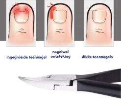 Medies - Professionele Zware Nageltang Voor Teennagels | Nagelknipper Teennagels | Ingegroeide Teennagel | Kalknagel | Harde Teennagels | Nagelschaar | Pedicure - Ingebouwde Veren -Maquillage Cosmetics 1200x1113 18