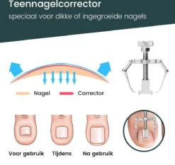 7-Delige Pedicure Set - Nagelverzorging - Nagelset Starterset - Ingegroeide Teennagel - Kalknagelproducten - Pedicuresets - RVS -Maquillage Cosmetics 1200x1130 11