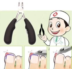 Professionele Nagelschaar Voor Ingegroeide Teennagels- Manicure - Pedicure - Voetverzorging -Maquillage Cosmetics 1200x1140 19