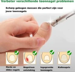 Merkloos Nageltang Met Gebogen Bek + Vijl - Nagelknipper Set - Pedicure Set -Maquillage Cosmetics 1200x1153 11