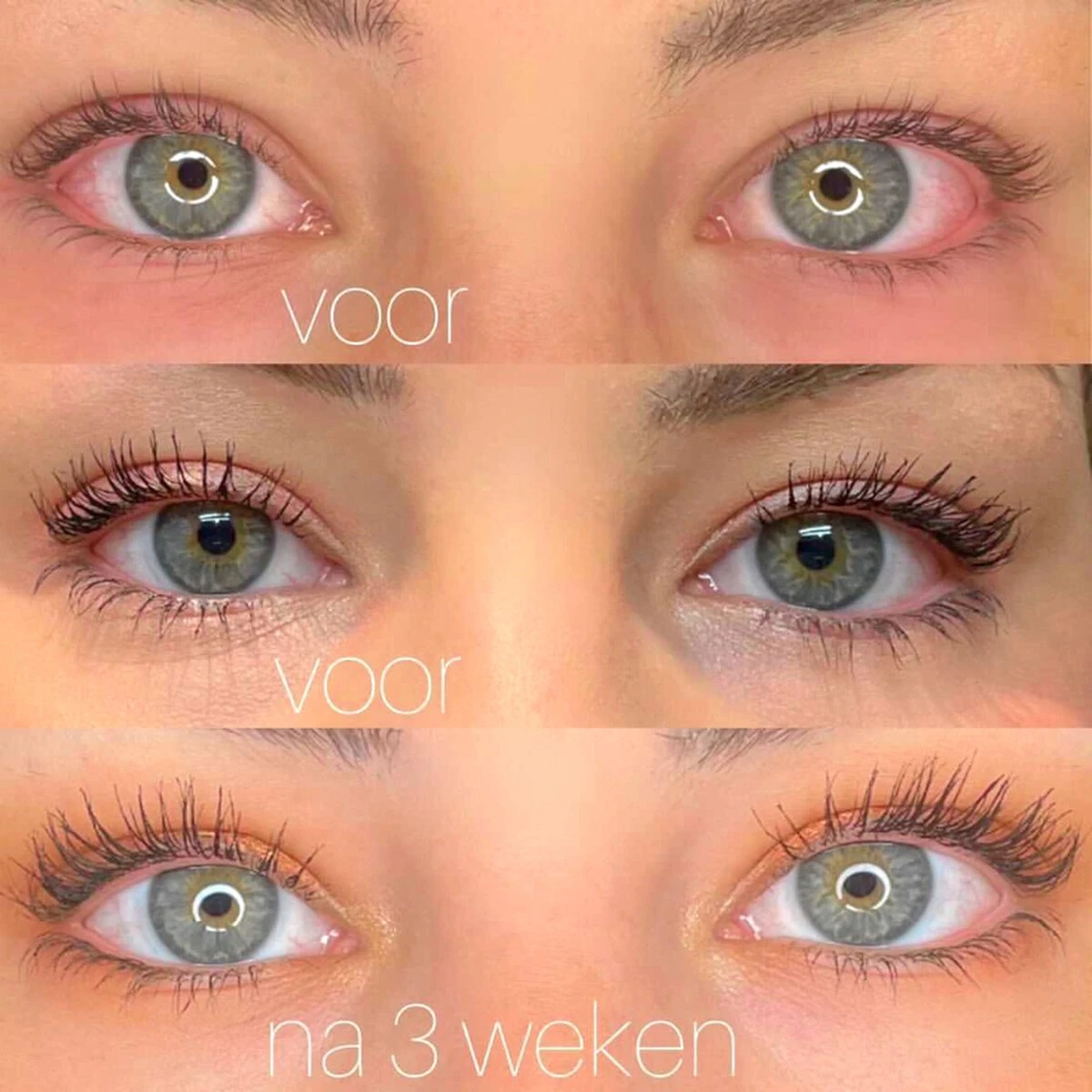 Célie Beauty FLASH - Wimperserum - Binnen 1 Week Zichtbaar Resultaat - 100% Vegan - Wimpergroei - Wimperverzorging - Volle Wimpers - Dikke Wimpers - 3ml - Hydraterend 5 Célie Beauty FLASH - Wimperserum - Binnen 1 Week Zichtbaar Resultaat - 100% Vegan - Wimpergroei - Wimperverzorging - Volle Wimpers - Dikke Wimpers - 3ml - Hydraterend – Image 3