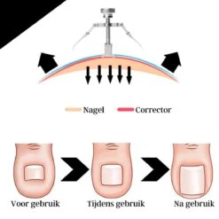 Merkloos STARMAN 7-delige Pedicure En Manicure Set - Nagelknipper - Pedicureset - Nagelvijl - Nageltang - Kalknagel - Teennagelknipper -Maquillage Cosmetics 1200x1200 3075