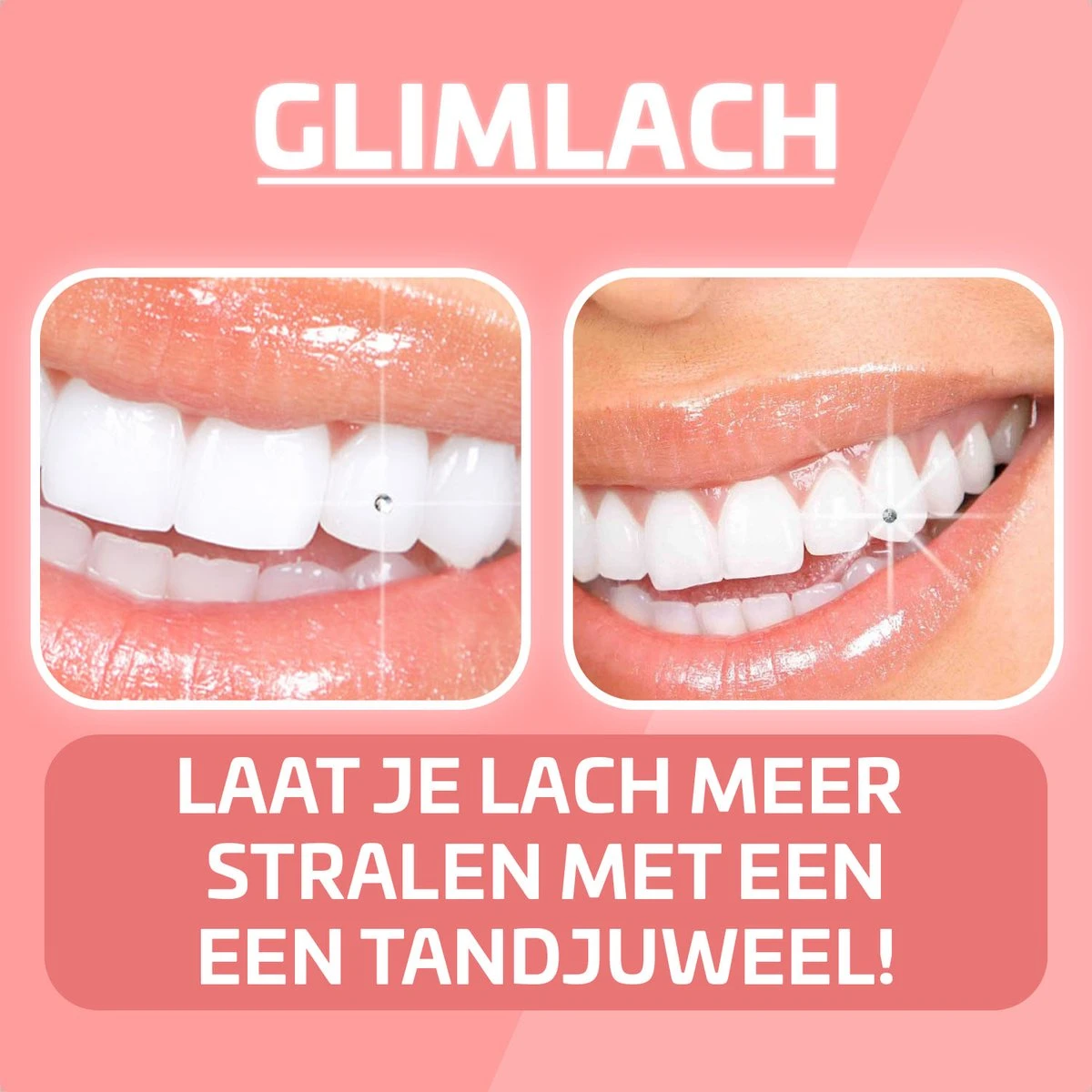 Nince DIY Tooth Gem Kit Hoogwaardig Materiaal - Wit Vlinder - Tand Diamantje Set 4 Nince DIY Tooth Gem Kit Hoogwaardig Materiaal - Wit Vlinder - Tand Diamantje Set – Image 2