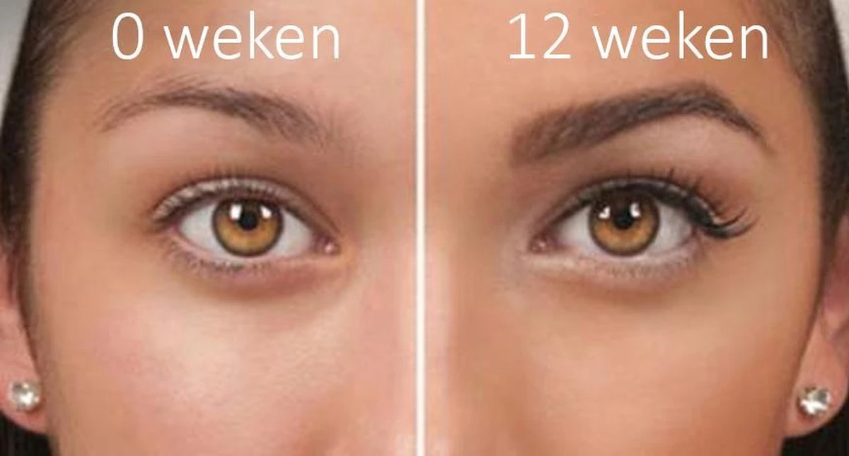 100% Natuurlijke Groei - Wenkbrauwserum - Vollere Wenkbrauwen - Castor Olie - Wenkbrauw Serum - 10ML 7 100% Natuurlijke Groei - Wenkbrauwserum - Vollere Wenkbrauwen - Castor Olie - Wenkbrauw Serum - 10ML – Image 5