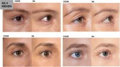 L'Oréal Paris Clinically Proven Wimperserum - 2 Ml -Maquillage Cosmetics 1200x670 3